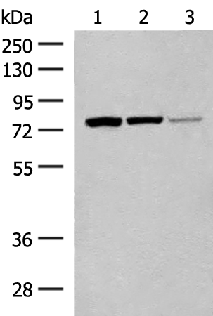 HNF1A