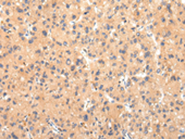 ATP7B 