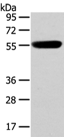 CBX4