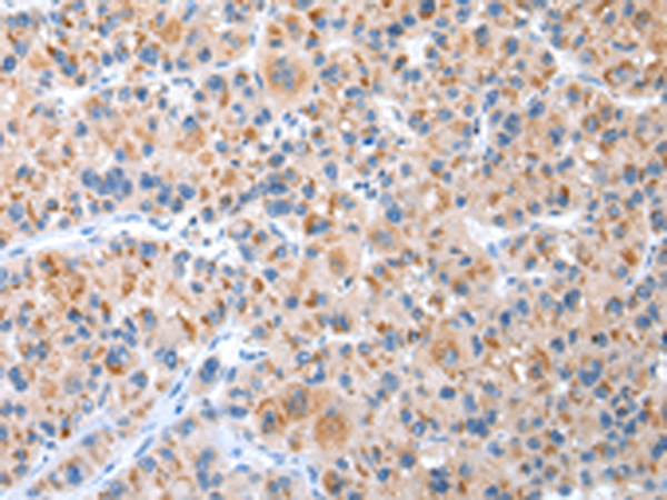 CXCR4