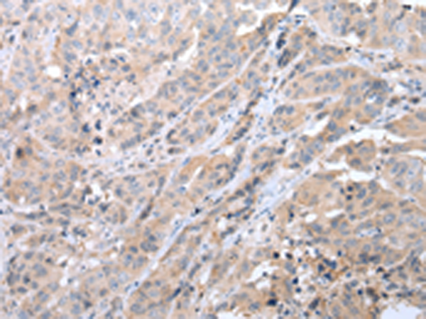 GJC1