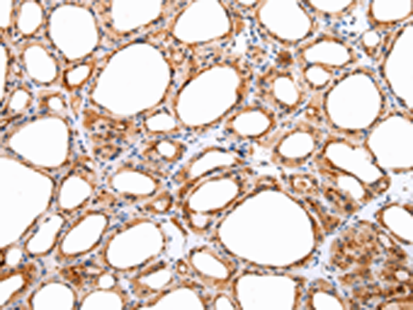 Rabbit Polyclonal Antibody to DVL1