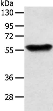 SLC1A3