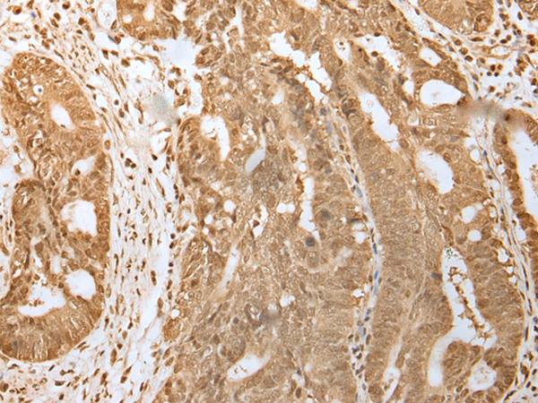 HDAC5