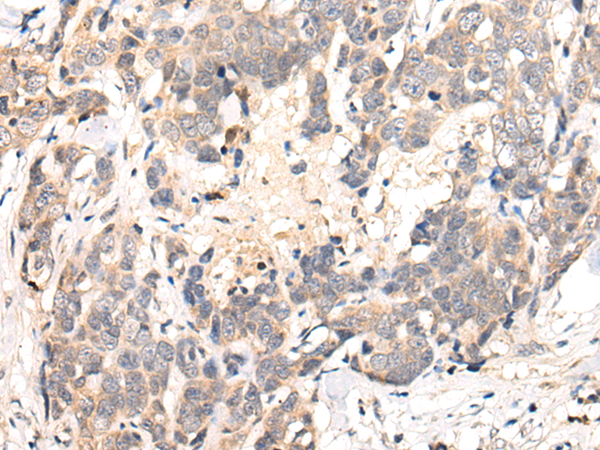 CHRNA6