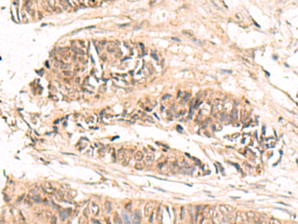 ABCB4