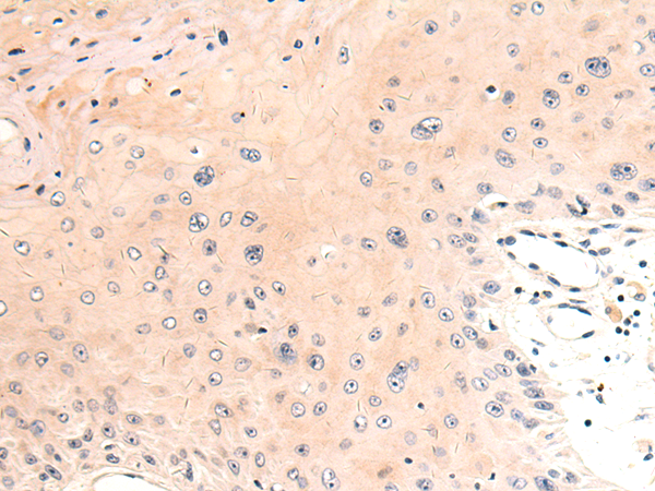 ABCB10