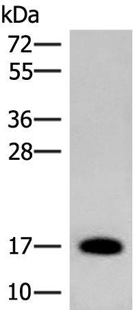 ADCYAP1