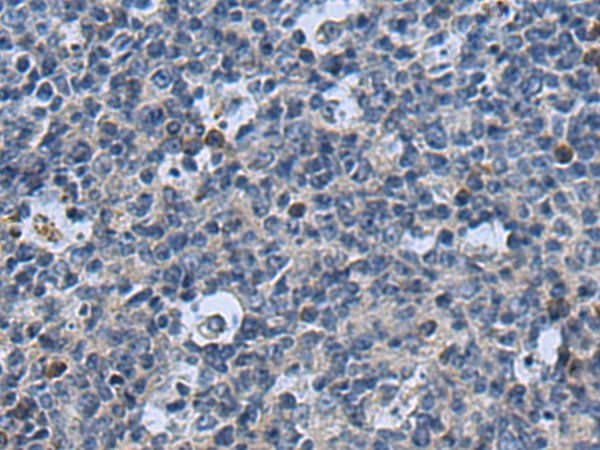 Rabbit Polyclonal Antibody to P2RY4