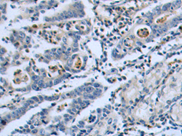 Rabbit Polyclonal Antibody to P2RY4