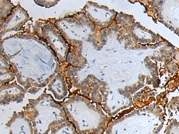 Rabbit Polyclonal Antibody to GTSE1