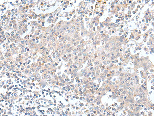 KCNH1