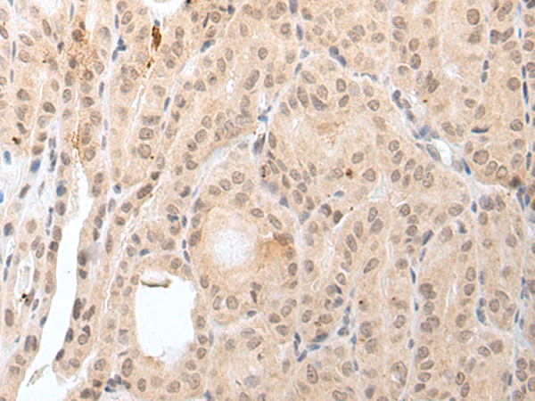 Rabbit Polyclonal Antibody to KCNH1