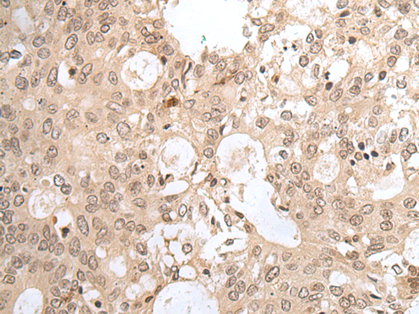 HCN3