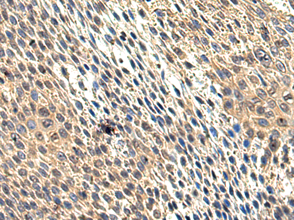 HDAC4