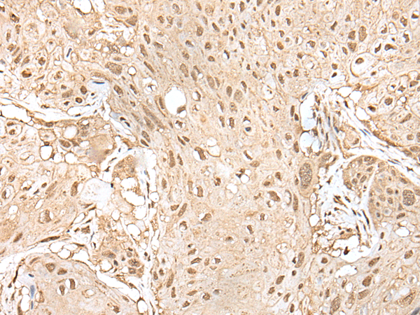 Rabbit Polyclonal Antibody to HOXA9