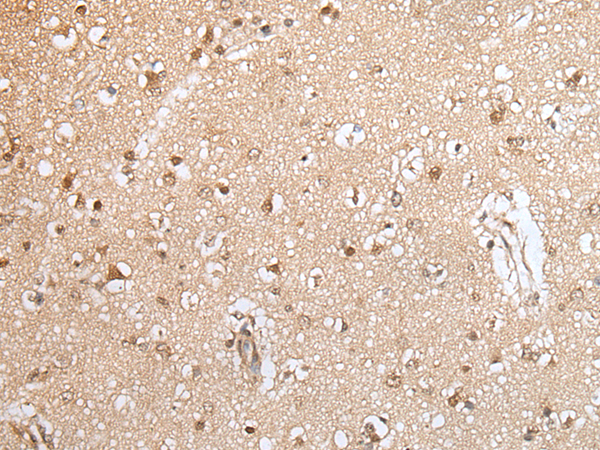 Rabbit Polyclonal Antibody to HOXA9