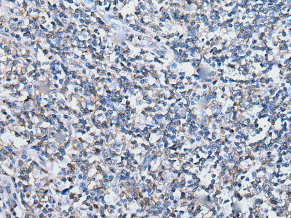 Rabbit Polyclonal Antibody to ACKR3