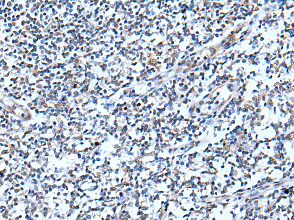 Rabbit Polyclonal Antibody to CDC34