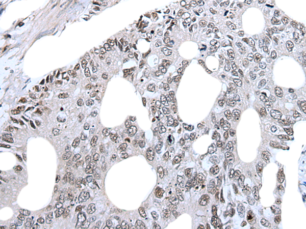 Rabbit Polyclonal Antibody to CDC34