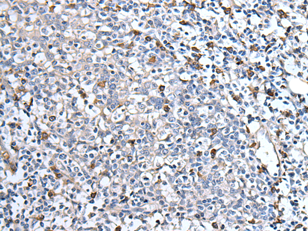 Rabbit Polyclonal Antibody to MEN1