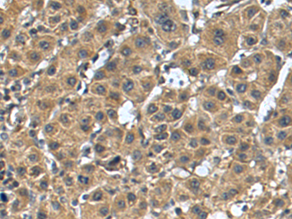 Rabbit Polyclonal Antibody to CNP