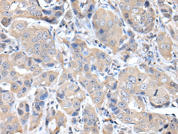 Rabbit Polyclonal Antibody to DES