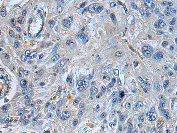 Rabbit Polyclonal Antibody to DOK2