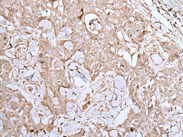 Rabbit Polyclonal Antibody to DUSP3