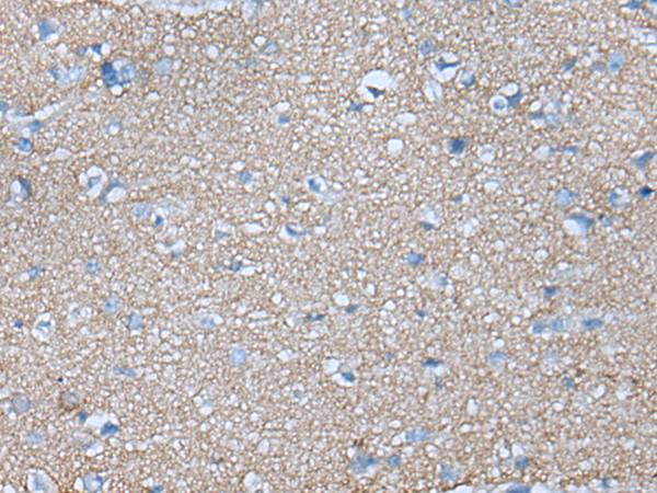 Rabbit Polyclonal Antibody to FABP3