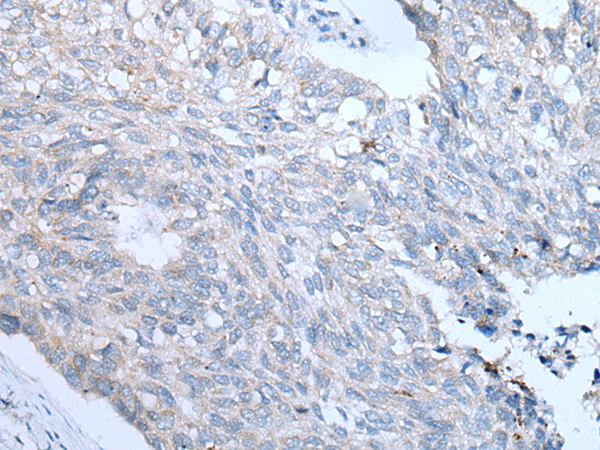 Rabbit Polyclonal Antibody to FABP3