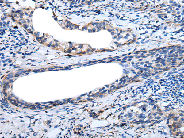 Rabbit Polyclonal Antibody to SERPINH1