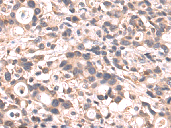 Rabbit Polyclonal Antibody to HTRA2