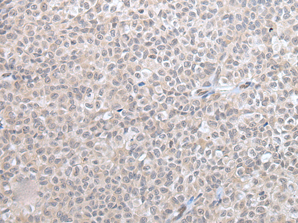 Rabbit Polyclonal Antibody to IFI16