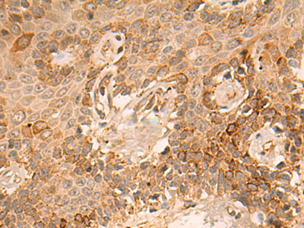 Rabbit Polyclonal Antibody to IFITM1