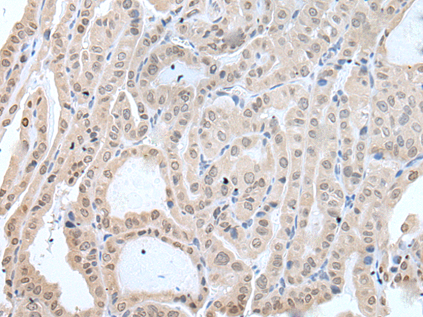 Rabbit Polyclonal Antibody to IFNB1