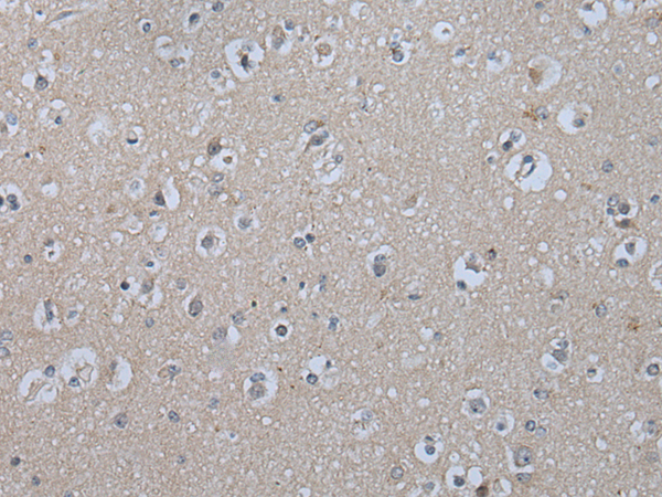 Rabbit Polyclonal Antibody to IL9R