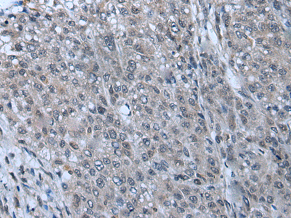 ZNF143