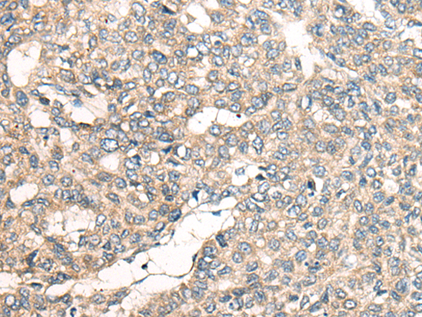 LRP1B