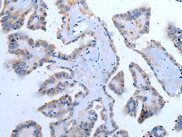 YPEL5
