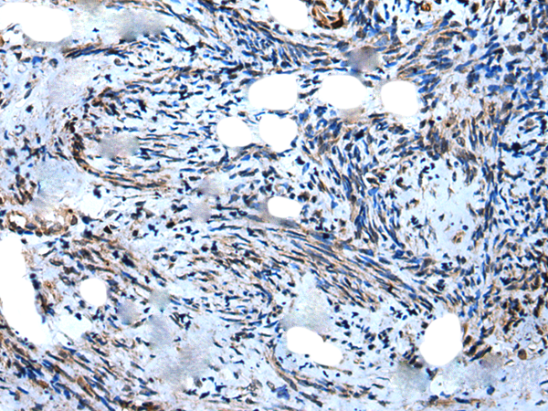 WIPF1