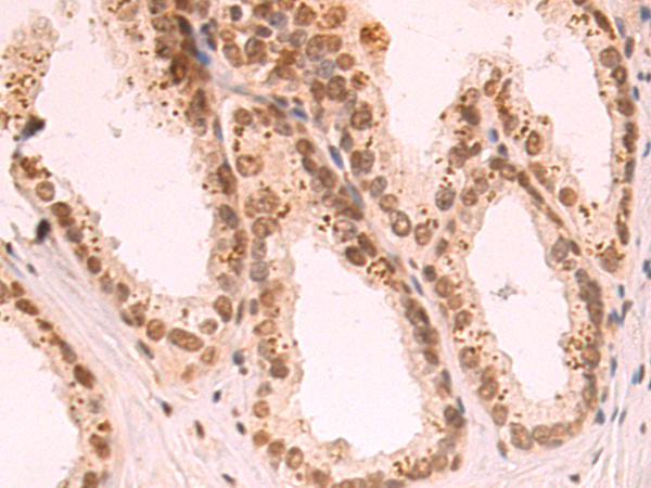 VAX1