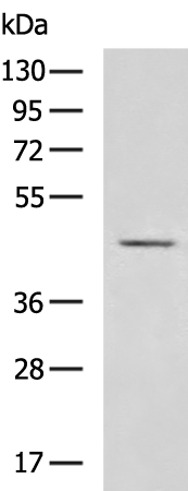 VPS36