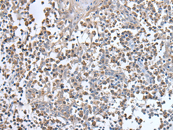 Rabbit Polyclonal Antibody to UBN1