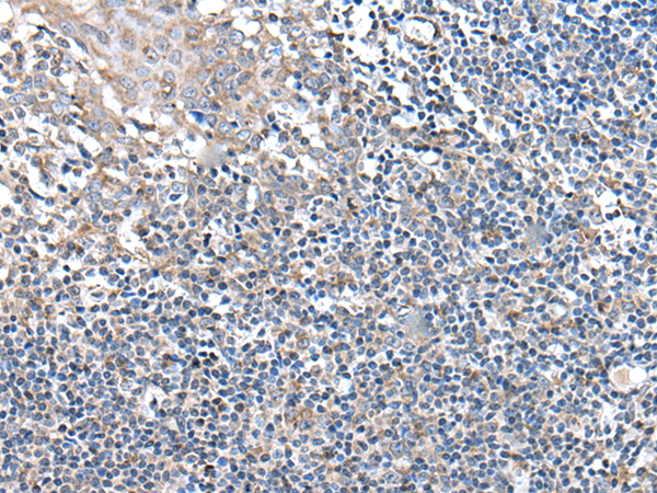 UBN2