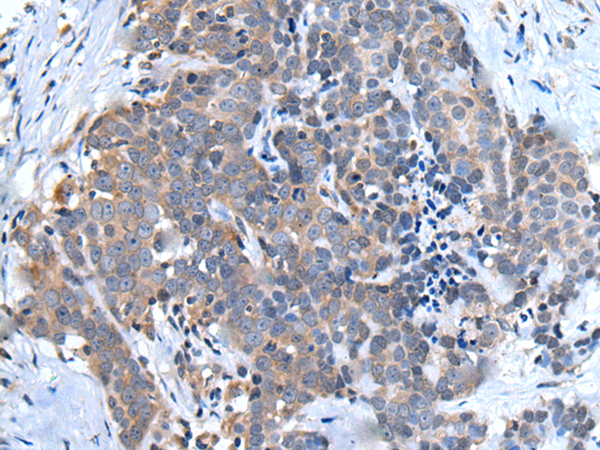 Rabbit Polyclonal Antibody to UBQLN2