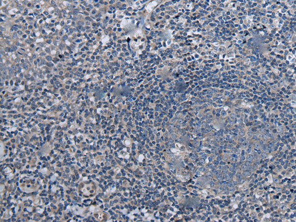 Rabbit Polyclonal Antibody to UBR4