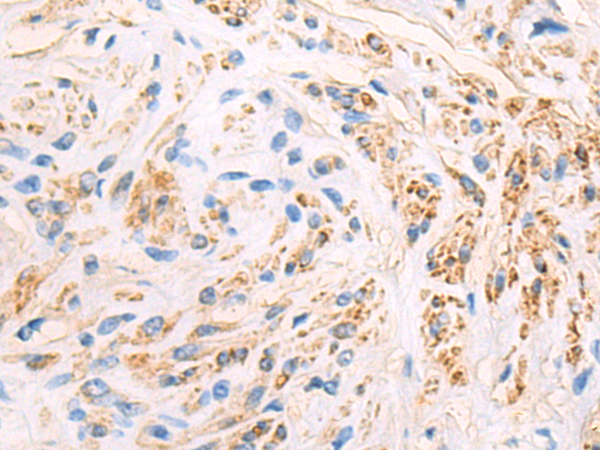 Rabbit Polyclonal Antibody to DSCC1