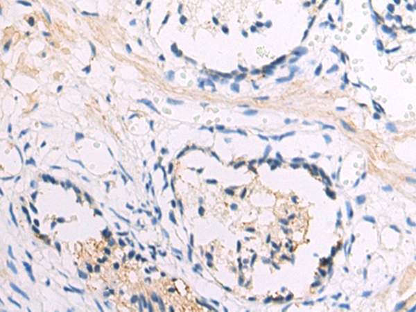 Rabbit Polyclonal Antibody to DSCC1
