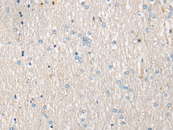 AVPR1B
